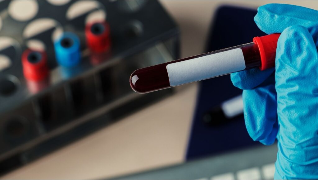 A gloved hand holding a blood sample test tube in a laboratory setting